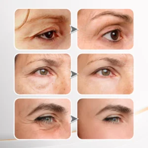 LOVILDS Skin Renewing Eye Cream For Wrinkles