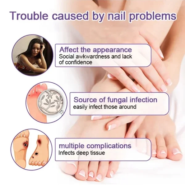 Nail care solution