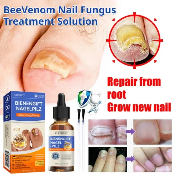 Nail care solution