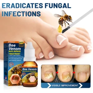 Fivfivgo™ Bee Venom Nail Repair Treatment