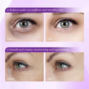 LOVILDS Skin Renewing Eye Cream For Wrinkles