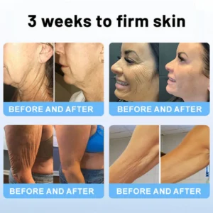 Flysmus® Skin Firming Cream,Addressing Crepe ＆ Sagging