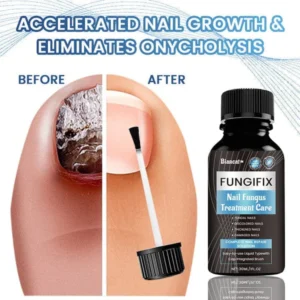 Biancat™ FungiFix Nail Fungus Treatment Care Fluid