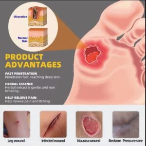 Diabetic Wounds Treatment Cream- Buy 1 Get 1