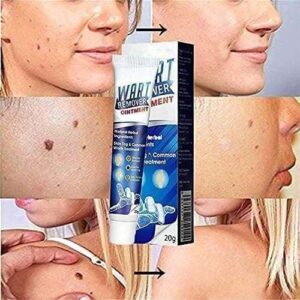 Wart Remover – Say Goodbye to Warts and Moles for Smooth, Healthy Skin