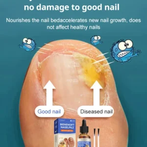 Nail care solution