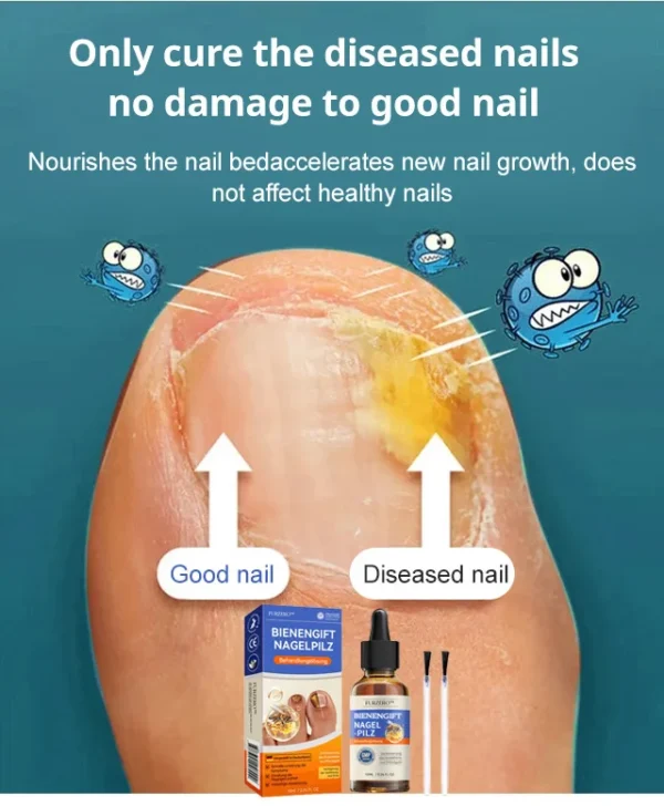 Nail care solution