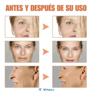 FivfivGO™ - Botox Facial Serum