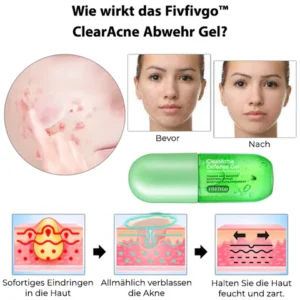 Fivfivgo™ ClearAcne Defense Gel