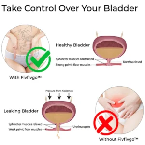 Fivfivgo™ Bladder Control Anti-Incontinence Gel