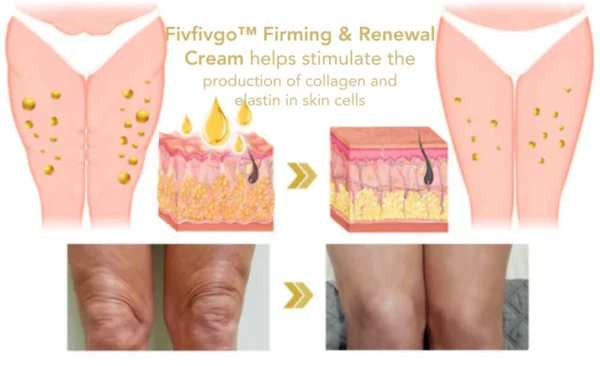 Fivfivgo™ Firming & Renewal Cream