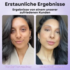 AEXZR™ Augenschwellungs Entferner Creme