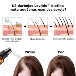 LOVILDS™ Biotin Hair Growth Serum