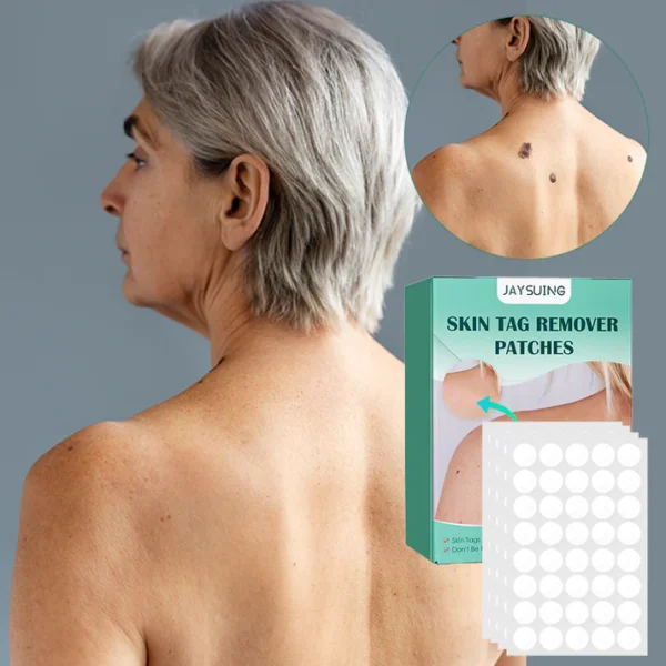 Skin Moles & Moles Removal Stickers - Image 2