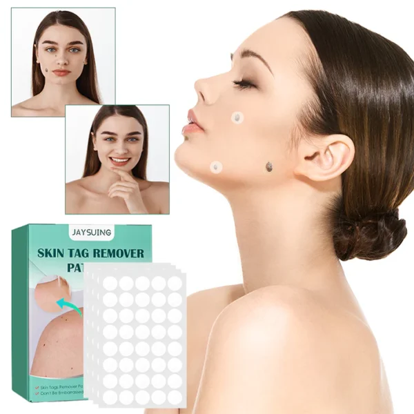 Skin Moles & Moles Removal Stickers - Image 4