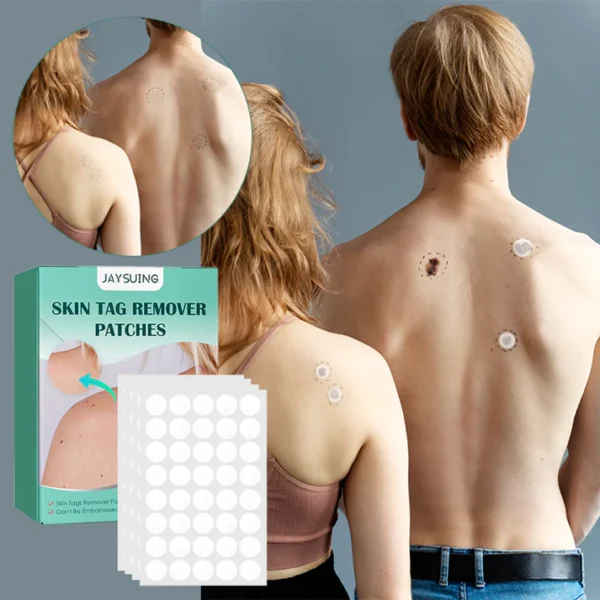 Skin Moles & Moles Removal Stickers - Image 5