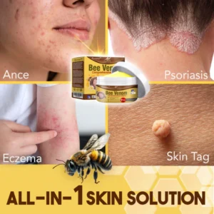 flysmus™ Bee Venom Comprehensive Skin Treatment Cream