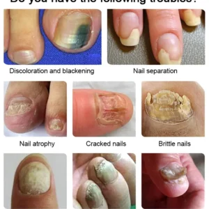 Nail care solution