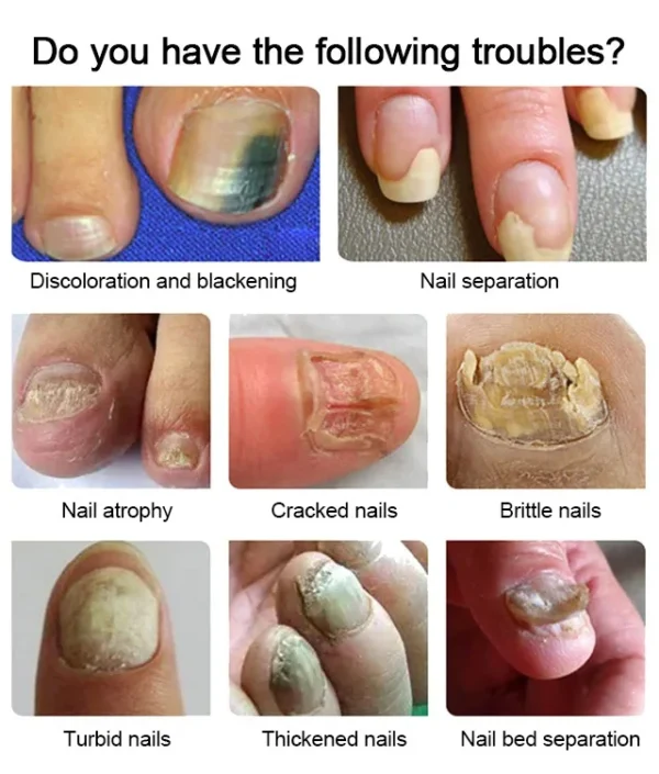 Nail care solution