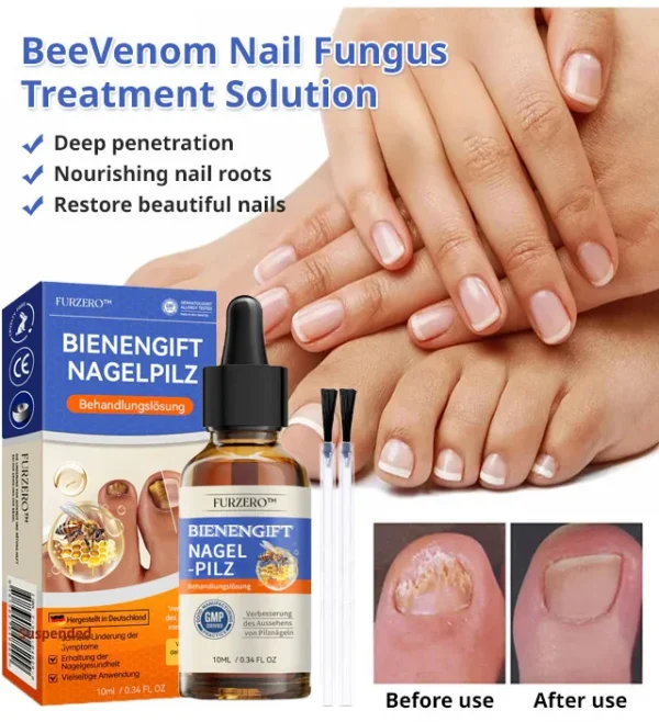 Nail care solution