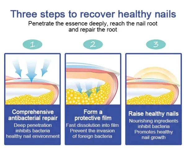 Nail care solution