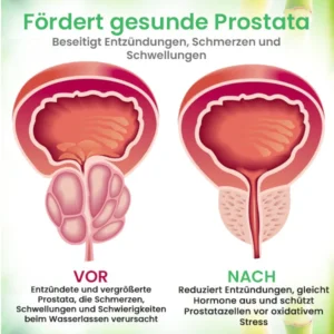 AEXZR™ Detox Prostata-Pflaster - Geheimnis jugendlicher Haut