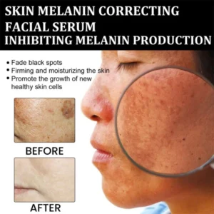 Fast Dark Spot Remover-NESLEMY™ Melanin Correcting Facial Serum