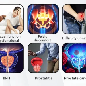 Say goodbye to prostate discomfort