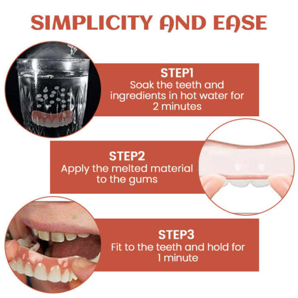 PerfectFit Denture Silicone Reline Kit