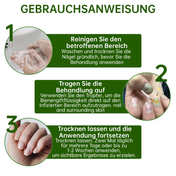 Dobshow™ Bienengift Nagelpilz-Behandlung Liquid