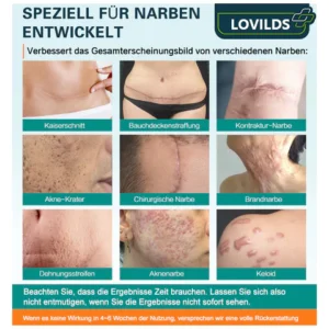 LOVILDS™ Advanced Scar Removal Spray