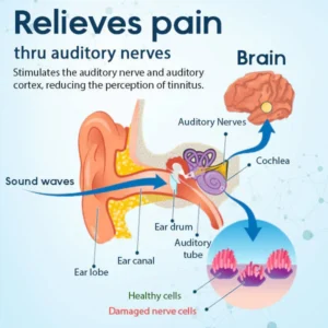 Fivfivgo™ ear patches for tinnitus treatment