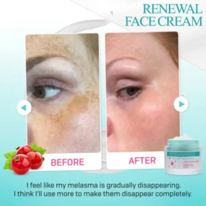 Renewal Face Cream