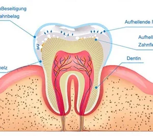 LIMETOW™ Teeth Whitening Essence