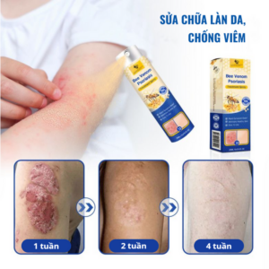 LOVILDS™ PsoriaHeal pro spray for psoriasis and eczema