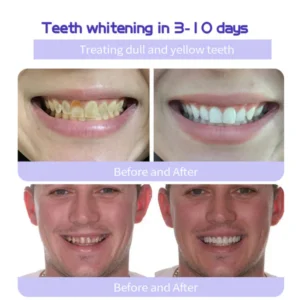 Fivfivgo™ Dental Restoration Mineral Powder