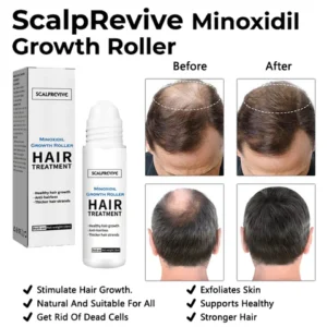 Fivfivgo™ ScalpRevive Minoxidil Growth Roller