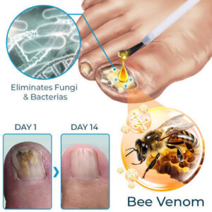 Furzero™ Nail Defense Bee Venom Treatment Serum