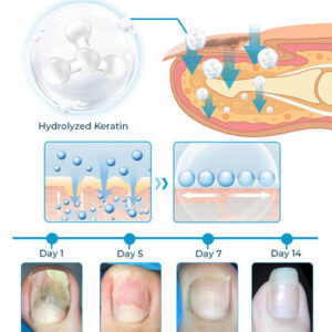 Furzero™ Nail Defense Bee Venom Treatment Serum