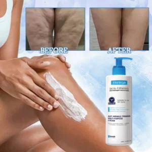 Fivfivgo™ Aescinex Herbal Edema Relief Massage Cream