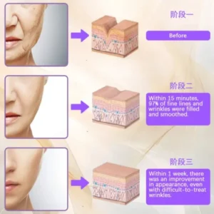 Furzero™ RolliLift Collagen Firming Cream