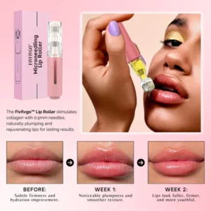 Fivfivgo™ MicroneedIing Lip Roller