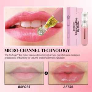 Fivfivgo™ MicroneedIing Lip Roller