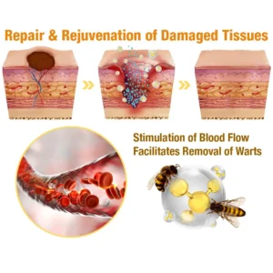 flysmus™ TagRecede Bees Treatment Spray