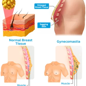 GFOUK™ MENIONIC Tourmaline Posture Correction Vest