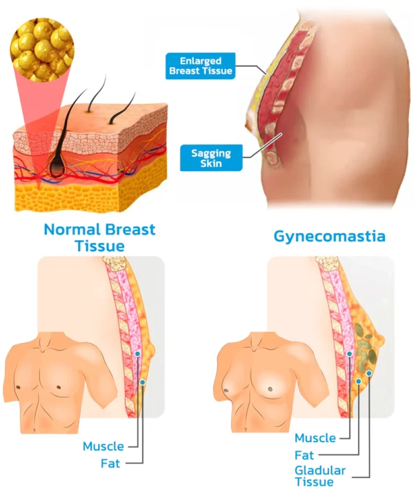 GFOUK™ MENIONIC Tourmaline Posture Correction Vest