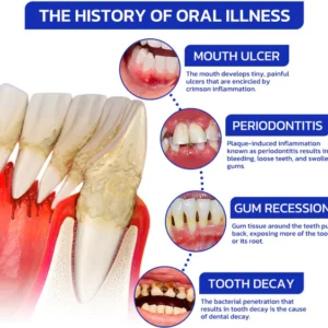 Furzero™ Focussmile Bee Venom Gum Therapy Oral Powder