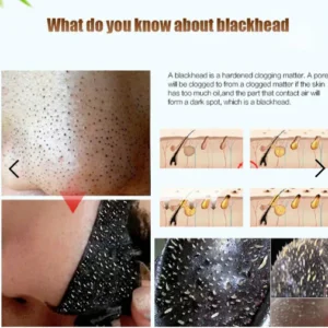 Black Head Nasal Patch