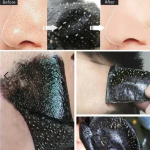 Black Head Nasal Patch