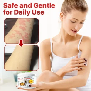 Multi-Symptom Psoriasis Care Anti-Itch Cream